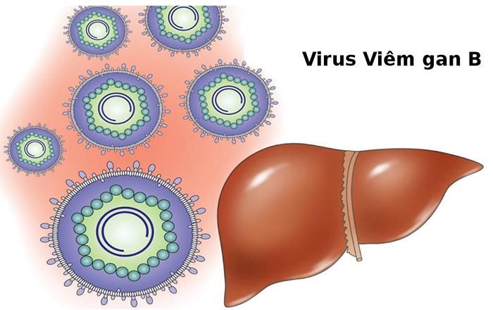 Theo thống kê có khoảng 20% số người nhiễm viêm gan virus có khả năng biến chứng thành xơ gan.
