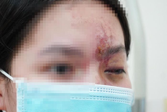 làm đẹp cấp tốc