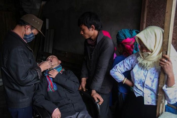 Một nam thanh niên đang được ông Mai Xuân Cồ lắp răng vàng. Không nhiều bằng phụ nữ nhưng một số nam giới vùng cao cũng chơi răng vàng. Ảnh chụp khoảng năm 2009 - 2010