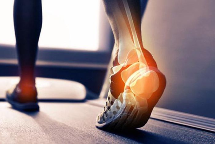 Hoạt động quá tải gây ra những vấn đề cho khớp cổ chân.