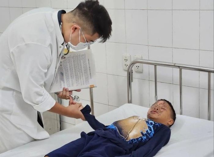 Bác sĩ thăm khám trường hợp bị bỏng nặng do đốt pháo mua trên mạng