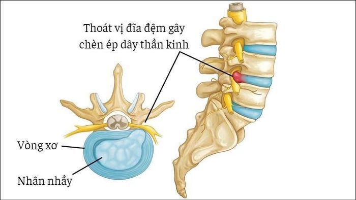 Ảnh minh họa: ITN