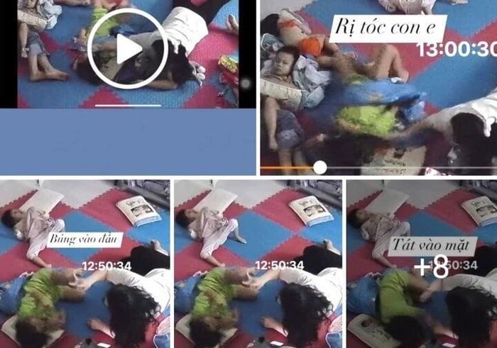 Hình ảnh cháu N. bị bảo mẫu bạo hành. (Ảnh: phụ huynh cung cấp)