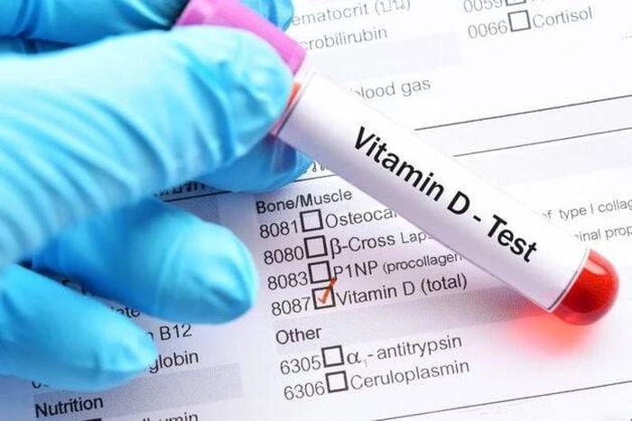  Bác sĩ có thể đánh giá mức vitamin D của trẻ thông qua xét nghiệm máu… 