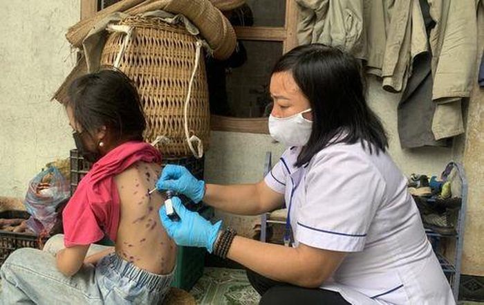 Cán bộ y tế ở tỉnh Lào Cai xuống các hộ gia đình để thăm khám, chữa trị bệnh thủy đậu cho học sinh 