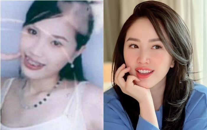 Công chúa bong bóng cũng từng niềng răng để cải thiện thẩm mỹ gương mặt.