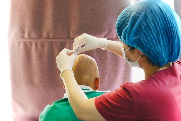 Bệnh nhân điều trị chứng rụng tóc tại Bệnh viện Da liễu Trung ương. Ảnh: Ngọc Nga