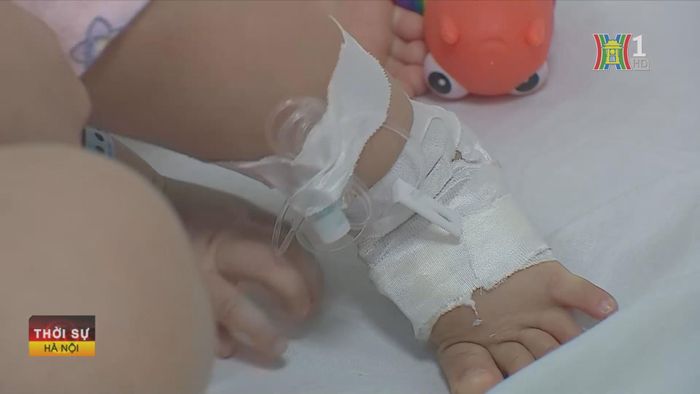 Cộng dồn từ đầu năm 2024 đến nay, trên địa bàn thành phố ghi nhận 778 trường hợp mắc tay chân miệng, 18 ổ dịch tay chân miệng.