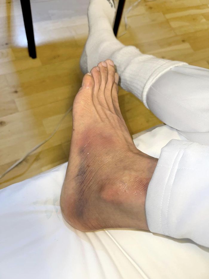 Đan Trường chia sẻ ảnh bàn chân bị thương.