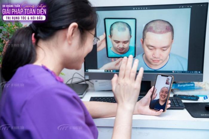 Khách hàng hài lòng sau khi thực hiện cấy tóc công nghệ ARTAS iX.