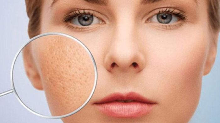 Sữa chua giúp e khít lỗ chân lông.