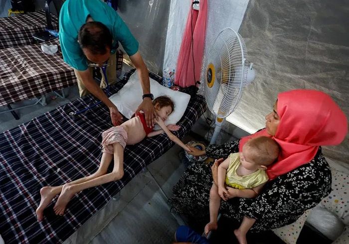 Bác sĩ kiểm tra Jana Ayad, một cô bé Palestine suy dinh dưỡng, khi bé điều trị tại bệnh viện dã chiến của Quân đoàn Y tế Quốc tế ở Deir el-Balah ở trung tâm Gaza. Ảnh: Mohammed Salem/Reuters.