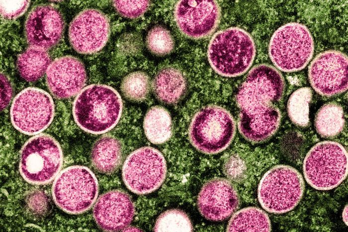  Ảnh chụp bằng kính hiển vi điện tử của virus mpox. Ảnh: National Institute of Allergy and Infectious Diseases. 