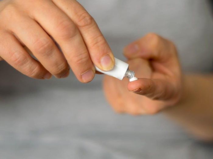 Một số loại thuốc bôi ngoài da có thể điều trị được bệnh ghẻ.