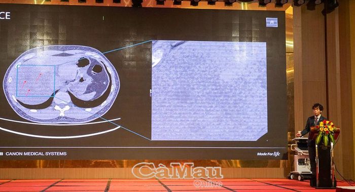Chuyên gia của Công ty Canon Medical Systems Asia (Singapore) chia sẻ về sử dụng AI trong ngành Y tế.