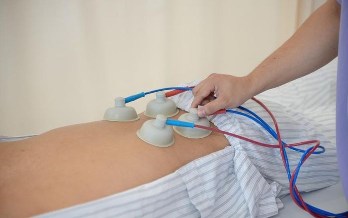 Áp dụng phương pháp vật lý trị liệu nhằm phục hồi chức năng cho người mắc hội chứng đuôi ngựa.