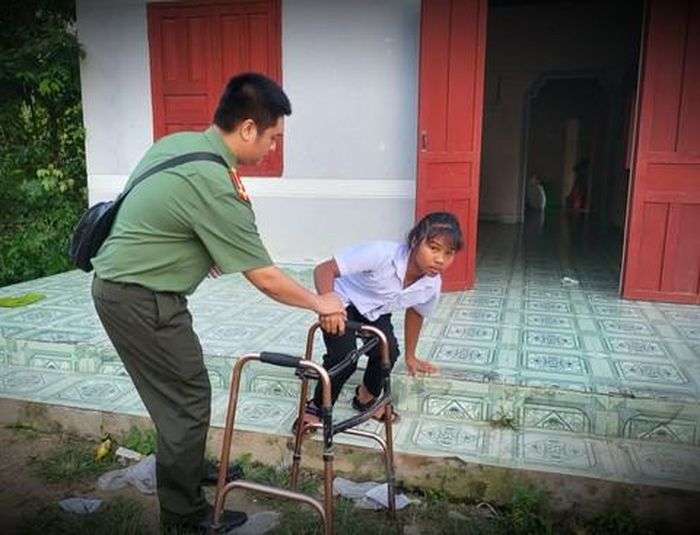 Các vết thương để lại di chứng tật nguyền cho em Tro Thị Thanh Trúc sau đêm kinh hoàng
