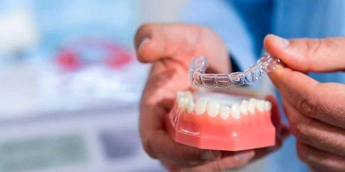 Niềng răng invisalign mang đến tính thẩm mỹ cao và có giá niềng răng đắt nhất hiện nay