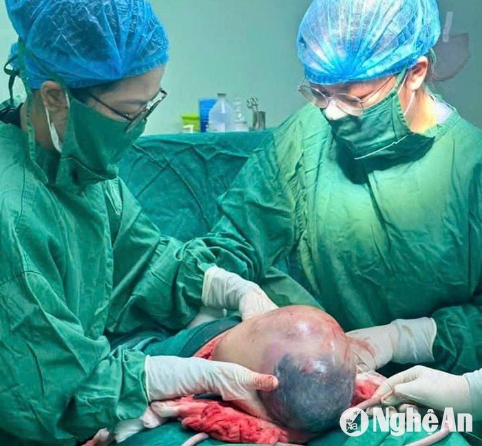 Bé trai con sản phụ Nguyễn Thu H. sinh ra vẫn nằm trong bọc ối. Ảnh: Hoàng Yến