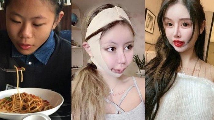 Quá trình thay đổi diện mạo của Zhou Chuna. (Ảnh tổng hợp)