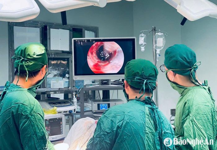 Các bác sĩ tiến hành phẫu thuật nội soi loại bỏ khối máu tụ, giải phóng chèn ép và bảo tồn chức năng não bộ. Ảnh: Hồ Hà