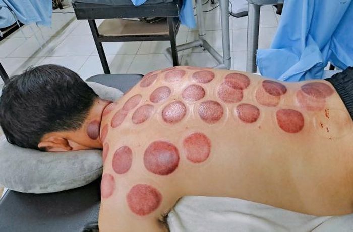 Các bài thuốc xông được bác sĩ online hướng dẫn người dân trên mạng xã hội.