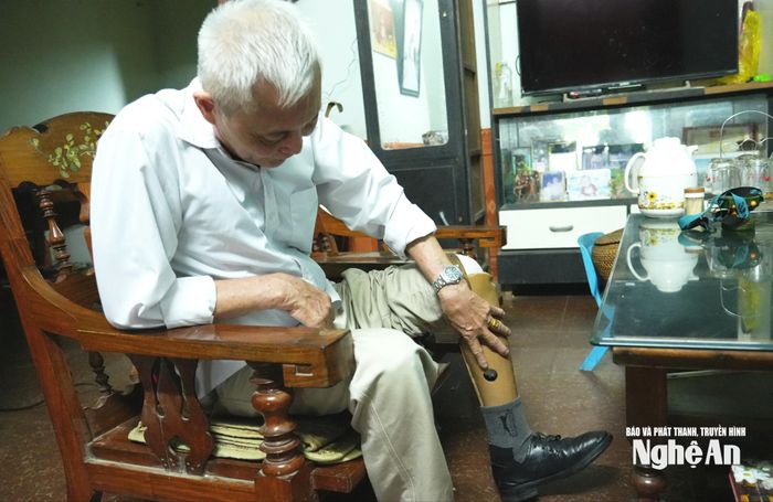 Thương binh Nguyễn Văn Đông với chiếc chân giả. Ảnh: Minh Quân