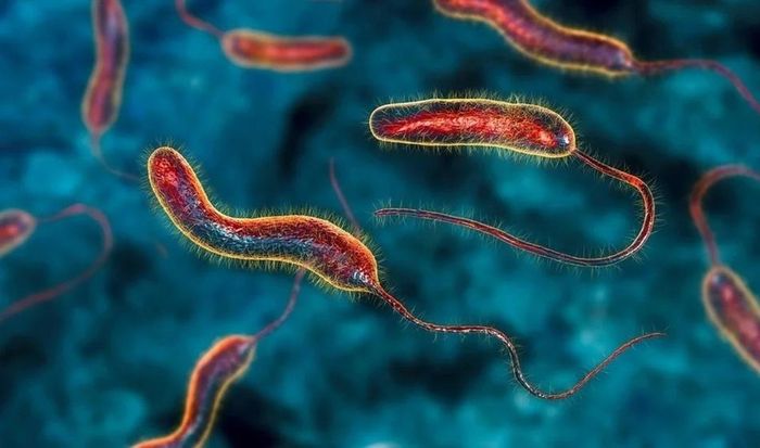 Tả do vi khuẩn Vibrio cholerae gây ra. Ảnh: News-Medical.