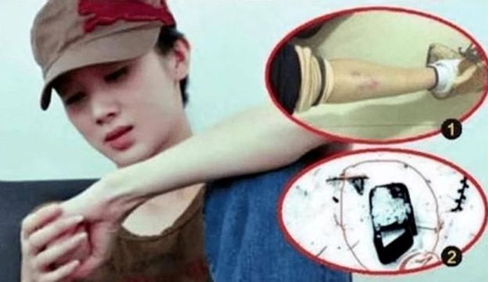 Vụ bạo hành trên phim trường để lại ám ảnh cho Tôn Phi Phi.