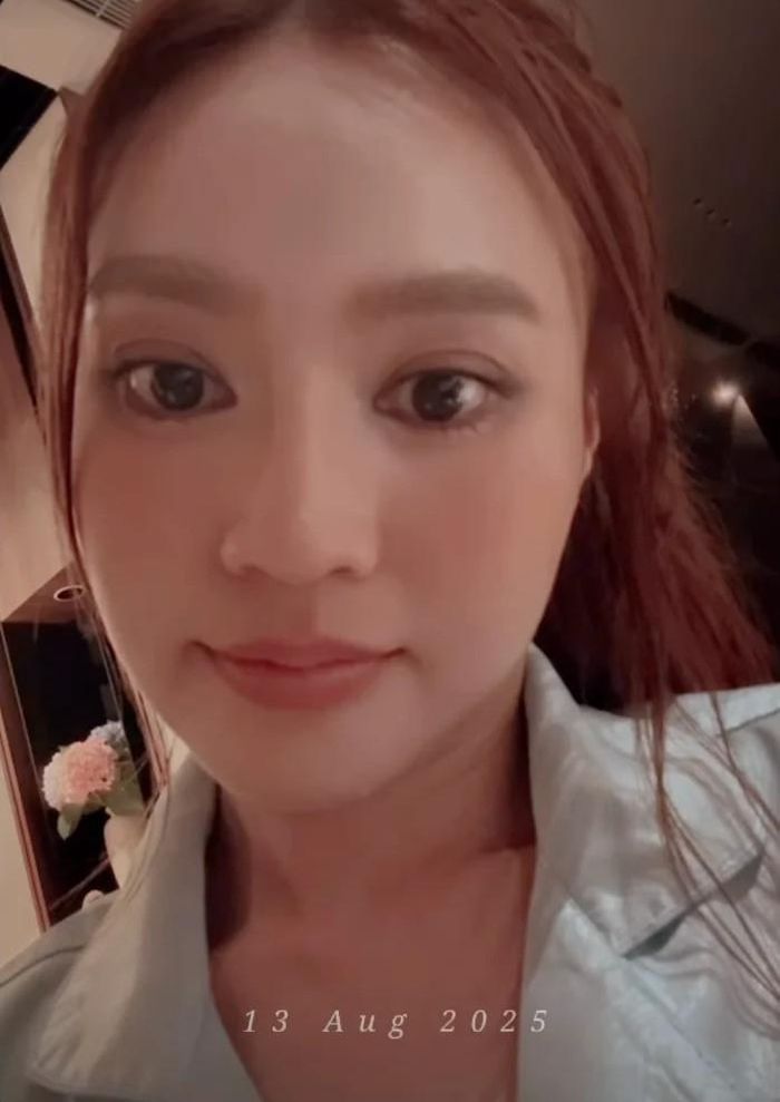 Nữ diễn viên từng cập nhật hình ảnh cận mặt hồi tháng 8 vừa qua, tiết lộ bị tăng cân, dị ứng thuốc. (Ảnh FBNV)