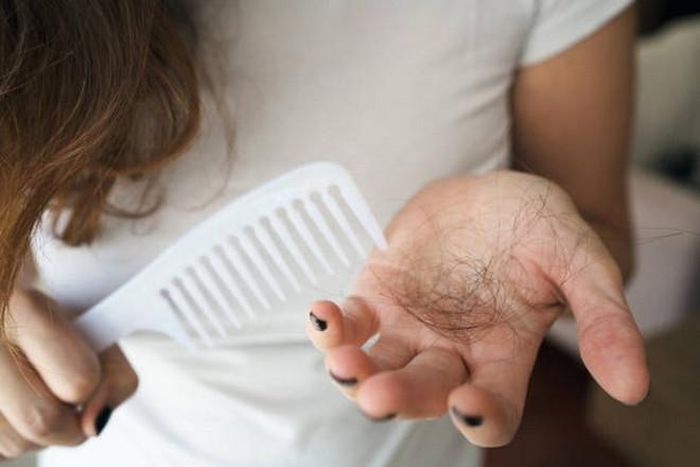 Rụng tóc bất thường có thể do thiếu sắt. (Ảnh: iStock)