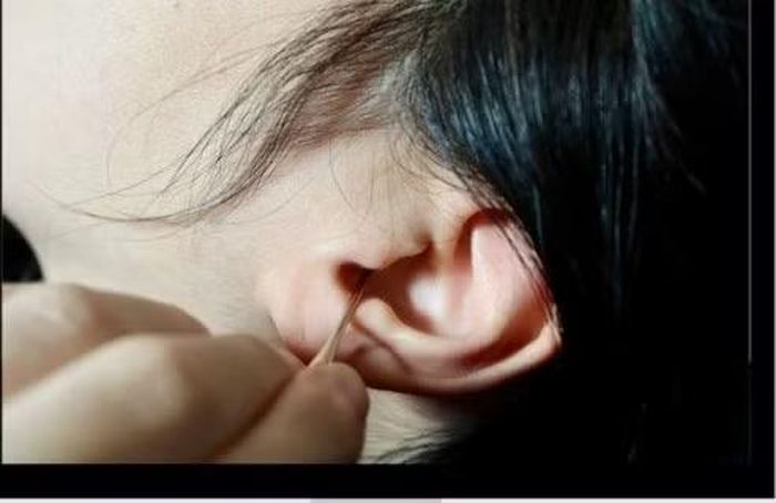 Không nên dùng tăm bông đưa sâu vào tai - Ảnh minh họa BSCC