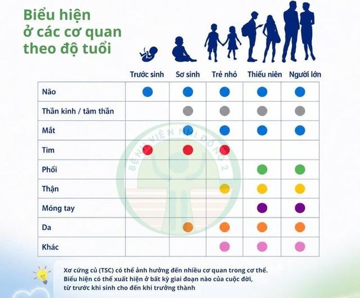 Các biểu hiện ở các cơ quan theo độ tuổi khi mắc hội chứng xơ cứng củ. Ảnh: BVCC.