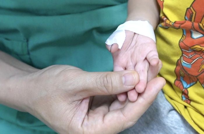 Bàn tay em bé hồng hào sau khi được phẫu thuật căn bệnh tim bẩm sinh nguy hiểm. Ảnh: BVCC
