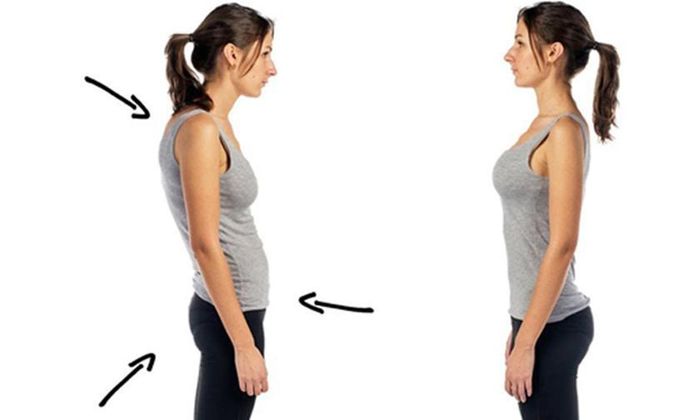 Cần điều chỉnh tư thế đứng gù lưng hoặc ưỡn bụng quá mức.