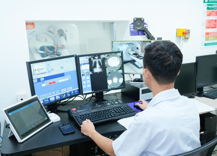 Chụp CT liều thấp để phát hiện kịp thời những bất thường, nốt mờ trên phổi.