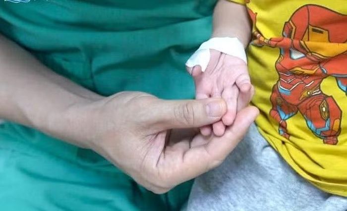 Bàn tay trẻ hồng hào sau khi hồi phục - Ảnh BVCC