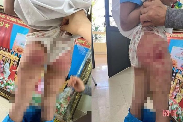 Vụ việc bé gái lớp 5 tại xã Cổ Đạm, tỉnh Hà Tĩnh bị cha dượng bạo hành vào tháng 10/2025.