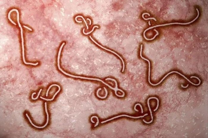 Virus gây bệnh Ebola - Nguồn ảnh: thenativeantigencompany.com