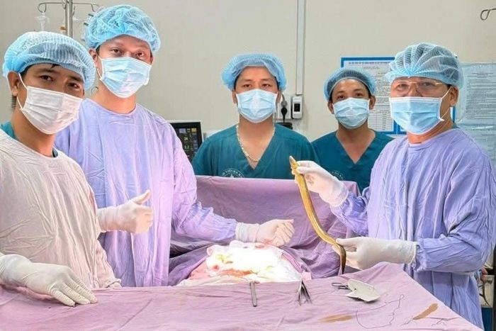 Các bác sĩ thực hiện ca phẫu thuật lấy con lươn trong ổ bụng ông L. Ảnh: L.N