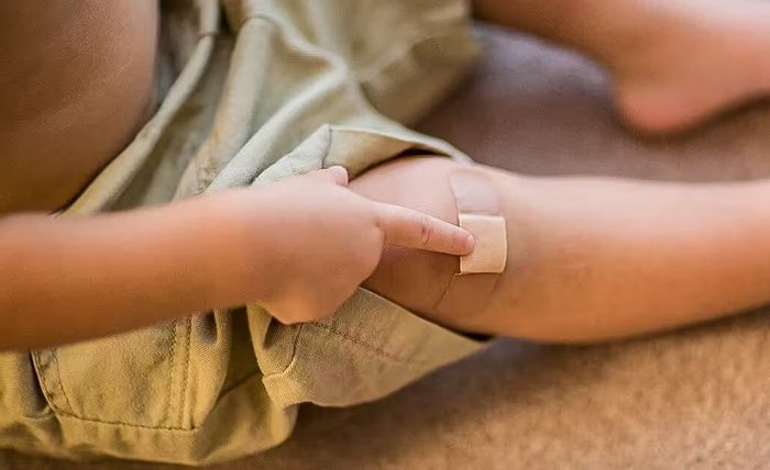 Một trong những dấu hiệu phổ biến nhất khi cơ thể thiếu kẽm là vết thương chậm lành. Ảnh: Healthline.