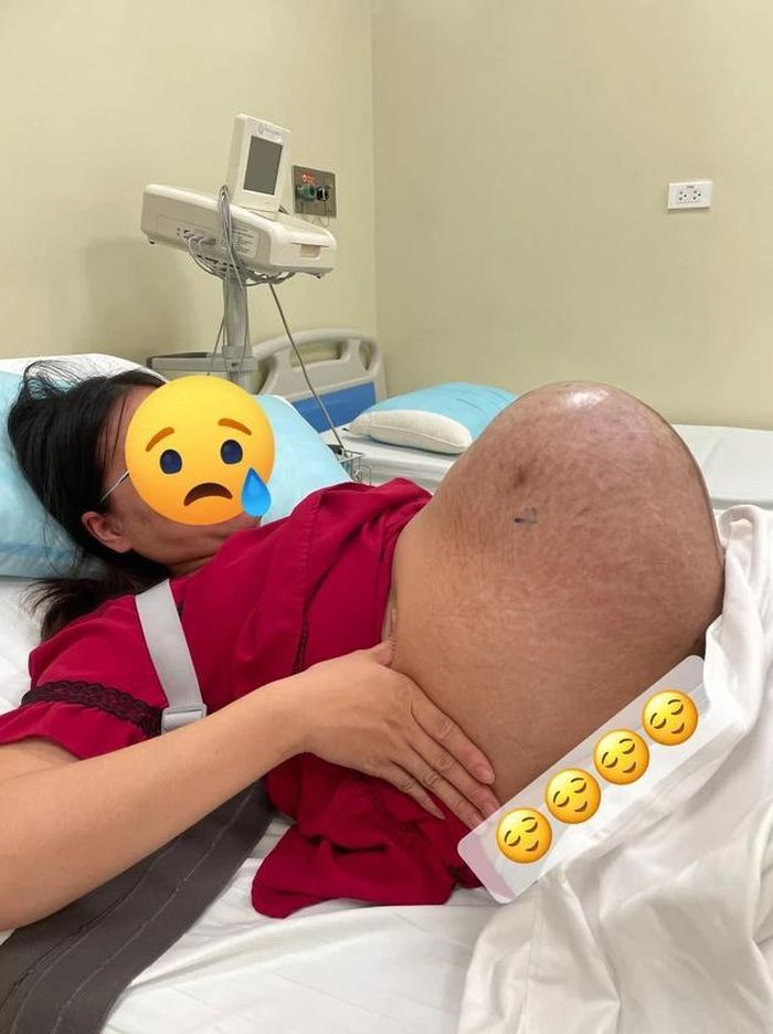 Loạt hình ảnh về chiếc bụng đầy vết rạn của mẹ bầu song thai sau khi được chia sẻ đã khiến nhiều người thêm thấu hiểu những hy sinh thầm lặng của phụ nữ trên hành trình làm mẹ.
