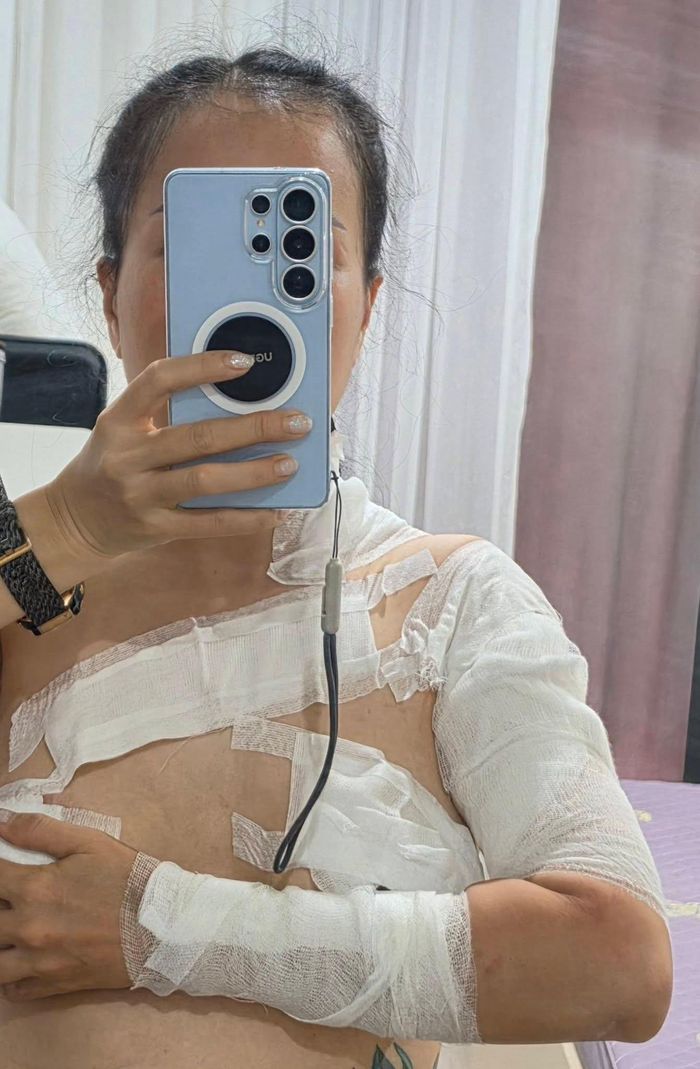  Chị Anh đề nghị chủ spa bồi thường thiệt hại song yêu cầu không được chấp nhận. 
