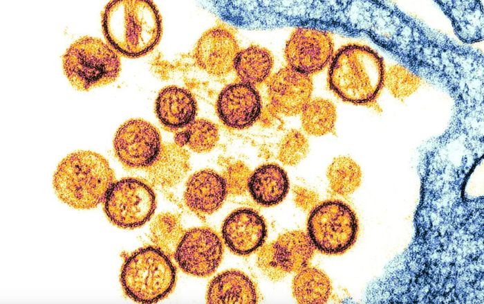 Ảnh hiển vi của một loại hantavirus được gọi là virus Sin Nombre, loại virus đã gây ra dịch bệnh ở phương Tây vào năm 1993. Ảnh: Science Source
