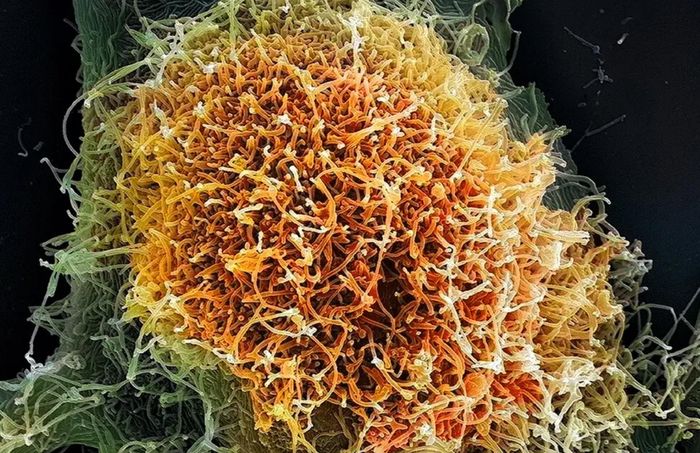 Ảnh hiển vi của các hạt virus Ebola. Có sáu loài virus giống Ebola đã được biết đến. Ảnh: Science Source