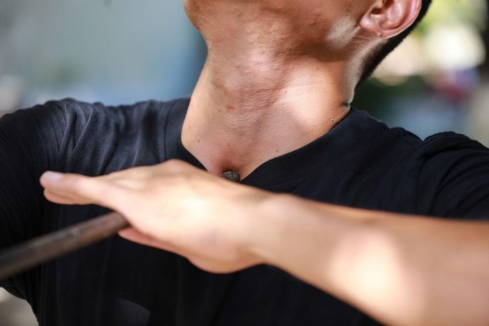  Cận cảnh vị trí đặt cây sắt phi 14 vào yết hầu. 