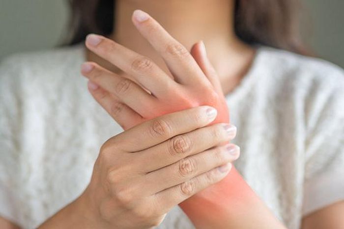 Khô mắt là biến chứng thường gặp ở bệnh nhân viêm khớp dạng thấp nhưng dễ bị bỏ qua. Ảnh: minh họa