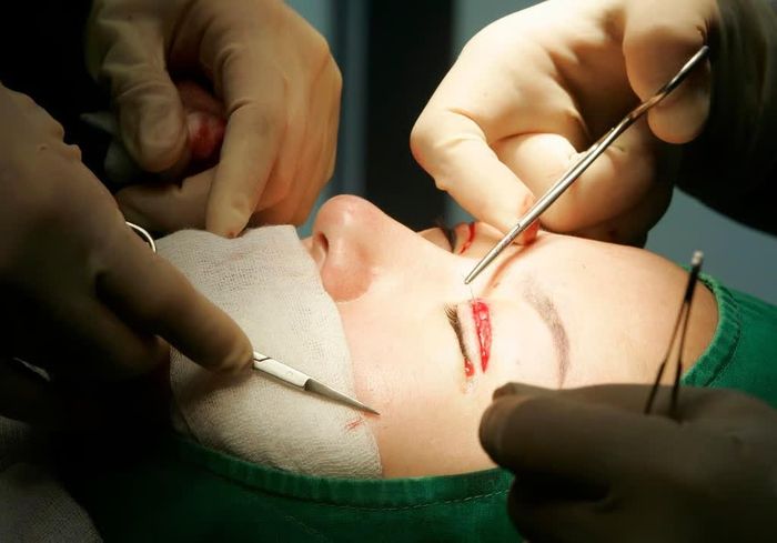  Phẫu thuật cắt mí được nhiều phụ nữ Trung Quốc lựa chọn. Ảnh: Reuters. 