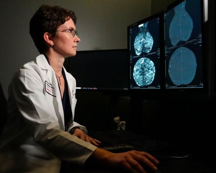 Xét nghiệm gene đột phá có thể giúp hàng triệu bệnh nhân ung thư vú không cần hóa trị. Ảnh: Houston Chronicle/Hearst Newspapers/Getty Images.