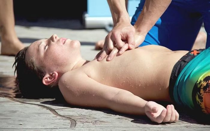 Khi thực hiện ép tim ngoài lồng ngực, cần thao tác đúng kỹ thuật, tránh ấn quá mạnh gây gãy xương sườn hoặc tổn thương phổi. Ảnh minh họa: INT.